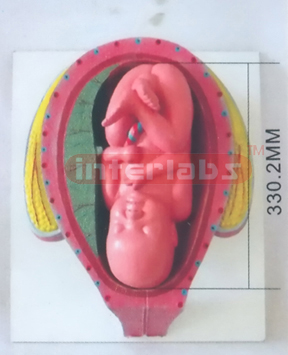 HUMAN PREGNANCY SERIES MODEL (9TH MONTH 45-46CM 2500GM)